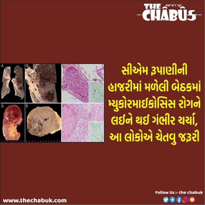 mucormycosis