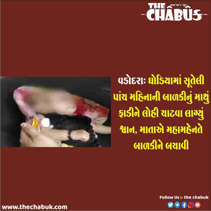 vadodara dog attack
